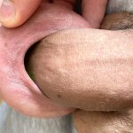 Foreskin extreme stretching porn: 5 Nude Pics