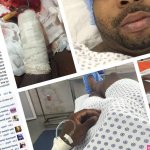 Rico Strong Suffers Caverject Dick Injury..